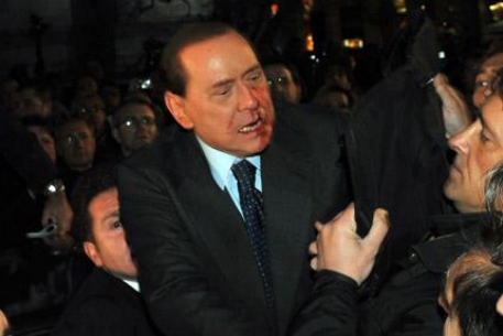 Окровавленное лицо Берлускони появится на предвыборных плакатах